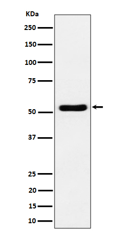 1 - Anti-GPRC5B Rabbit Monoclonal Antibody ABO16422