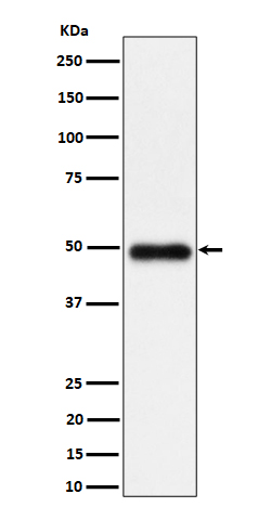 1 - Anti-NgR3 Rabbit Monoclonal Antibody ABO16423