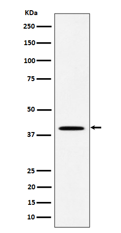 1 - Anti-DLX3 Rabbit Monoclonal Antibody ABO16424