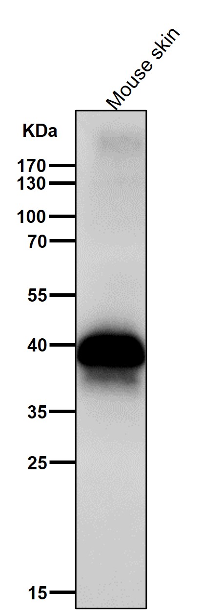1 - Anti-DLX3 Rabbit Monoclonal Antibody ABO16424