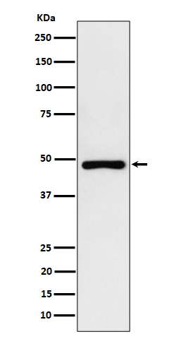 1 - Anti-PAH Rabbit Monoclonal Antibody ABO16426