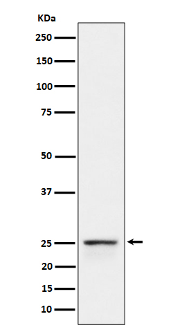 1 - Anti-PEX11B Rabbit Monoclonal Antibody ABO16430