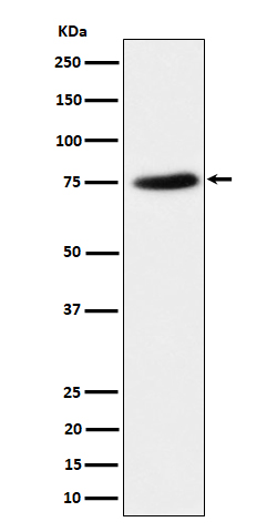 1 - Anti-PPM1G Rabbit Monoclonal Antibody ABO16437