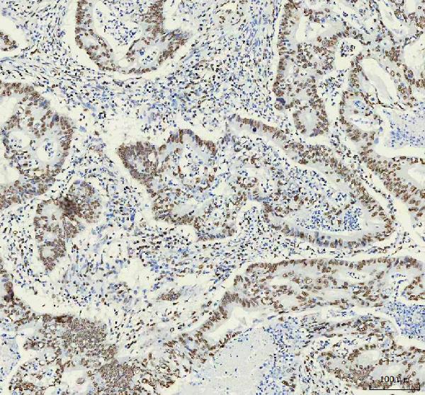 2 - Anti-HNRNPM Rabbit Monoclonal Antibody ABO16441
