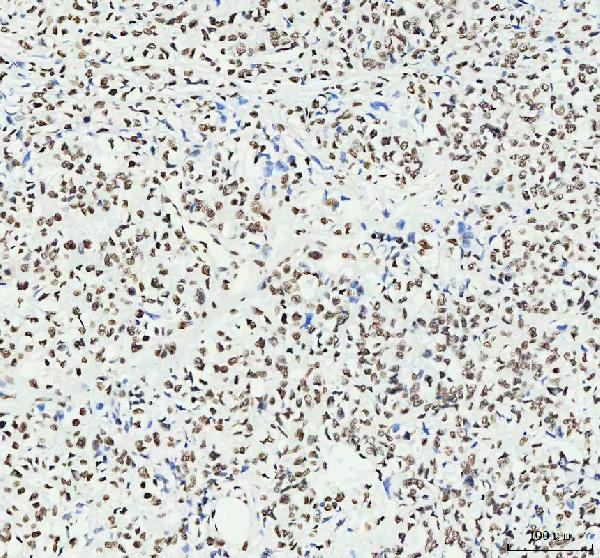 2 - Anti-HNRNPM Rabbit Monoclonal Antibody ABO16441