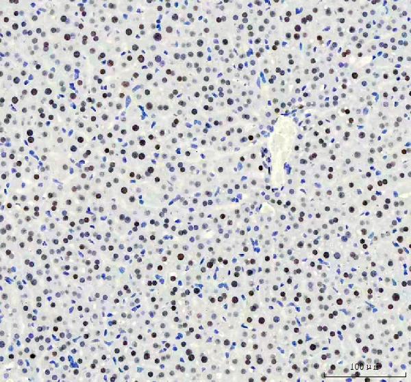 2 - Anti-HNRNPM Rabbit Monoclonal Antibody ABO16441