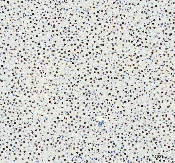 2 - Anti-HNRNPM Rabbit Monoclonal Antibody ABO16441