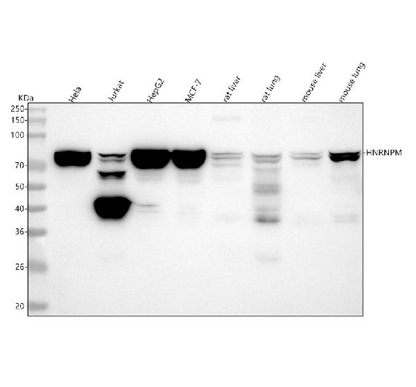 1 - Anti-HNRNPM Rabbit Monoclonal Antibody ABO16441