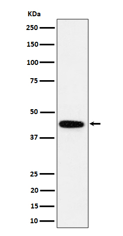 1 - Anti-GALT Rabbit Monoclonal Antibody ABO16445