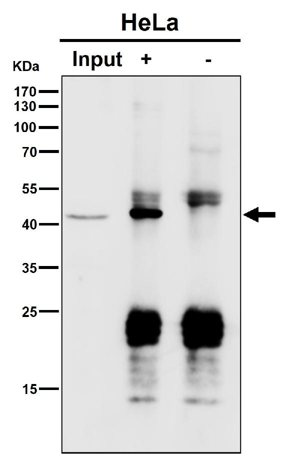 1 - Anti-PSMC5 Rabbit Monoclonal Antibody ABO16448