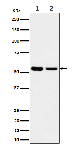 1 - Anti-AAMP Rabbit Monoclonal Antibody ABO16449