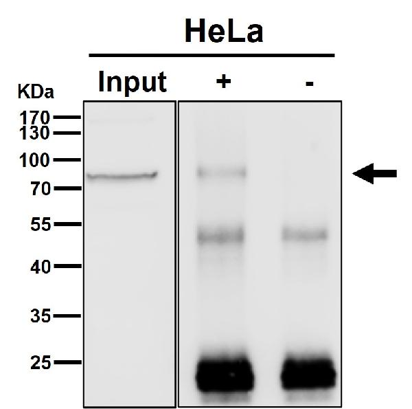 1 - Anti-BRAT1 Rabbit Monoclonal Antibody ABO16450