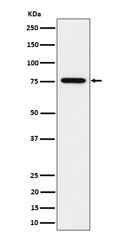 1 - Anti-BRAT1 Rabbit Monoclonal Antibody ABO16450