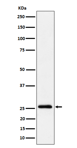 1 - Anti-TEMT Rabbit Monoclonal Antibody ABO16453
