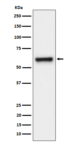1 - Anti-FPGS Rabbit Monoclonal Antibody ABO16454