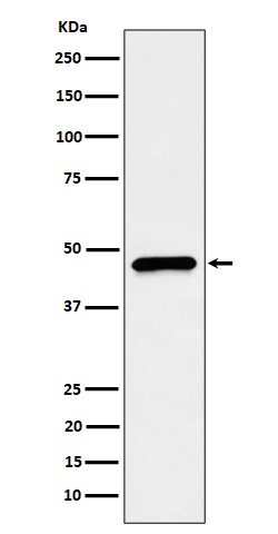1 - Anti-CECR5 Rabbit Monoclonal Antibody ABO16455