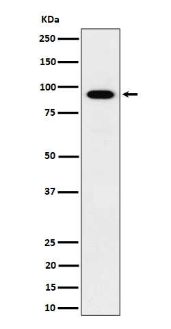 1 - Anti-IFT88 Rabbit Monoclonal Antibody ABO16456