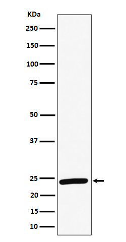 1 - Anti-RAB8A Rabbit Monoclonal Antibody ABO16458