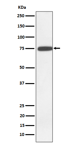1 - Anti-GNE Rabbit Monoclonal Antibody ABO16460