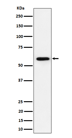 1 - Anti-PRPF31 Rabbit Monoclonal Antibody ABO16461