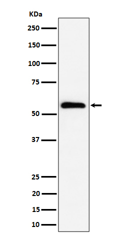1 - Anti-PNK / PNKP Rabbit Monoclonal Antibody ABO16464