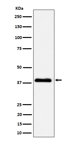 1 - Anti-NSDHL Rabbit Monoclonal Antibody ABO16465