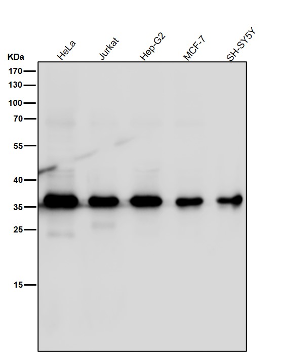 1 - Anti-MLD Rabbit Monoclonal Antibody ABO16467