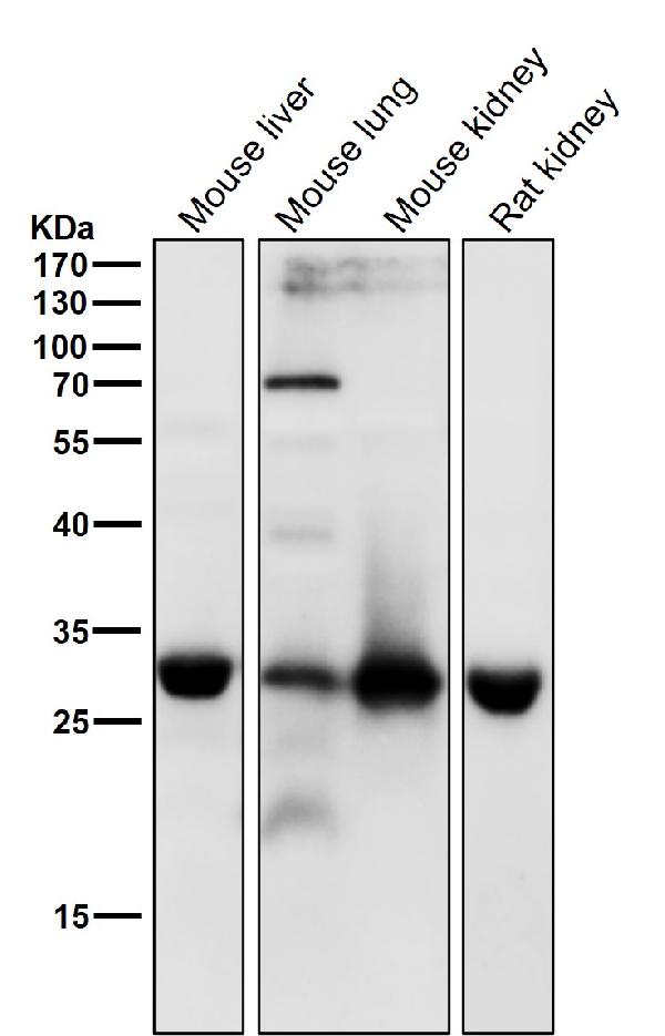 1 - Anti-TMEM192 Rabbit Monoclonal Antibody ABO16468