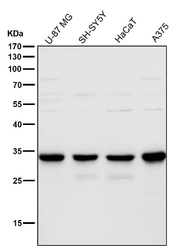 1 - Anti-TMEM192 Rabbit Monoclonal Antibody ABO16468