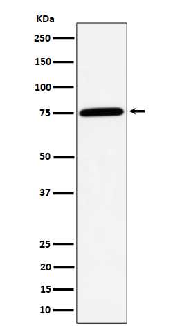 1 - Anti-PPM1G Rabbit Monoclonal Antibody ABO16470