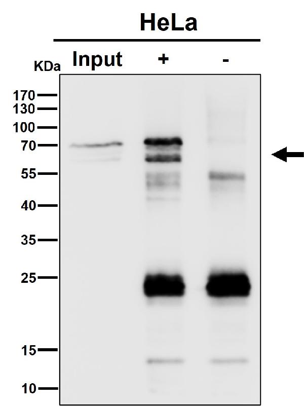 1 - Anti-PPP2R5D Rabbit Monoclonal Antibody ABO16471