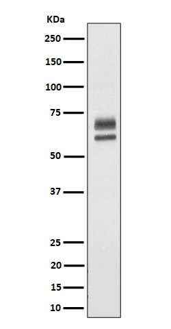 1 - Anti-PPP2R5D Rabbit Monoclonal Antibody ABO16471