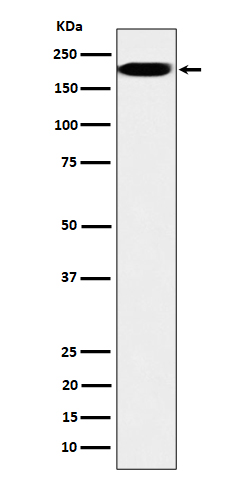 1 - Anti-IQGAP2 Rabbit Monoclonal Antibody ABO16472