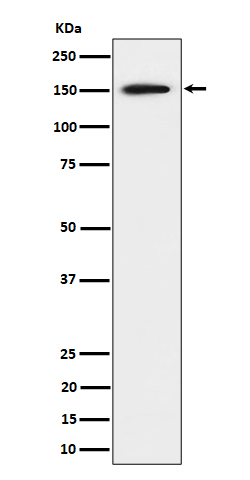 1 - Anti-SAFB Rabbit Monoclonal Antibody ABO16473