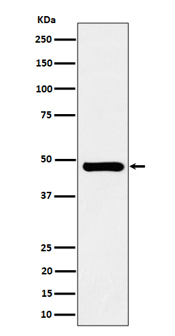 1 - Anti-SNX5 Rabbit Monoclonal Antibody ABO16475