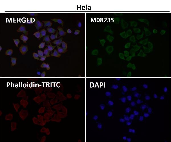 1 - Anti-AZI2 Rabbit Monoclonal Antibody ABO16477