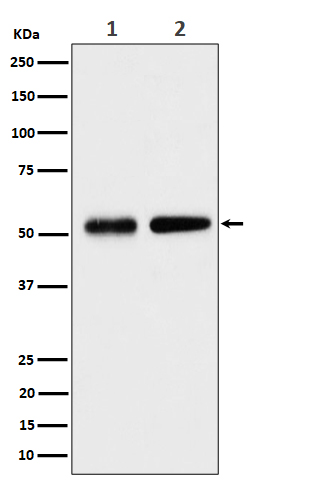 1 - Anti-Septin 8 Rabbit Monoclonal Antibody ABO16478