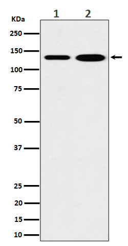 1 - Anti-MYO1B Rabbit Monoclonal Antibody ABO16480