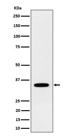 1 - Anti-NTH1 Rabbit Monoclonal Antibody ABO16481