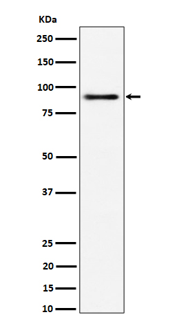 1 - Anti-ACAP2 Rabbit Monoclonal Antibody ABO16482