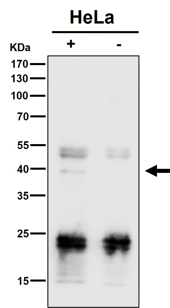 1 - Anti-PCBP2 Rabbit Monoclonal Antibody ABO16484