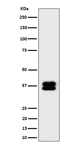 1 - Anti-PCBP2 Rabbit Monoclonal Antibody ABO16484