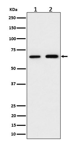 1 - Anti-PGM1 Rabbit Monoclonal Antibody ABO16485
