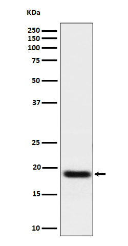 1 - Anti-TNFAIP8 Rabbit Monoclonal Antibody ABO16486
