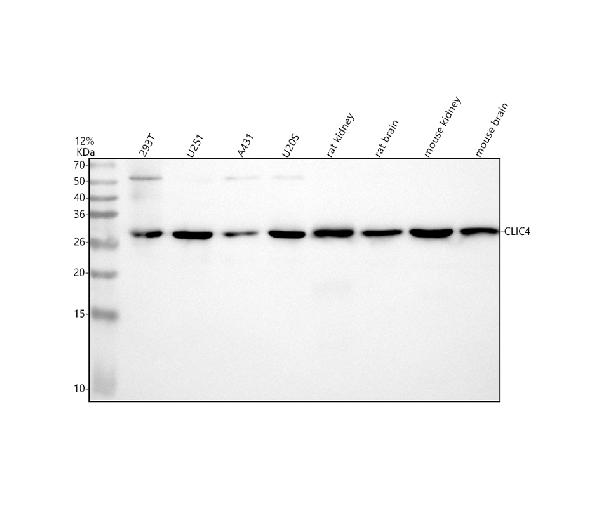 1 - Anti-CLIC4 Rabbit Monoclonal Antibody ABO16488