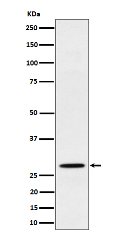 1 - Anti-PSMB10 Rabbit Monoclonal Antibody ABO16489