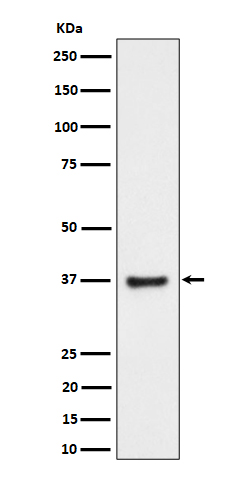 1 - Anti-RNF115 Rabbit Monoclonal Antibody ABO16490