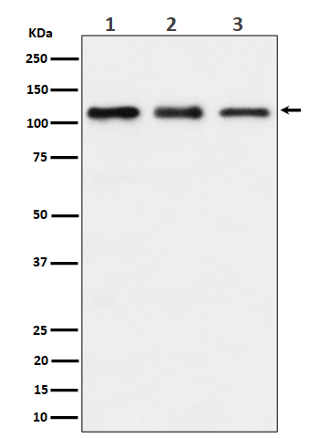 1 - Anti-TAOK1 Rabbit Monoclonal Antibody ABO16493