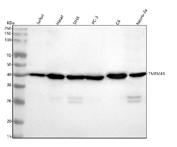 1 - Anti-TMEM43 Rabbit Monoclonal Antibody ABO16494