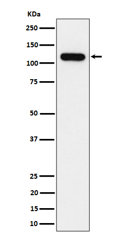 1 - Anti-NOLC1 Rabbit Monoclonal Antibody ABO16495